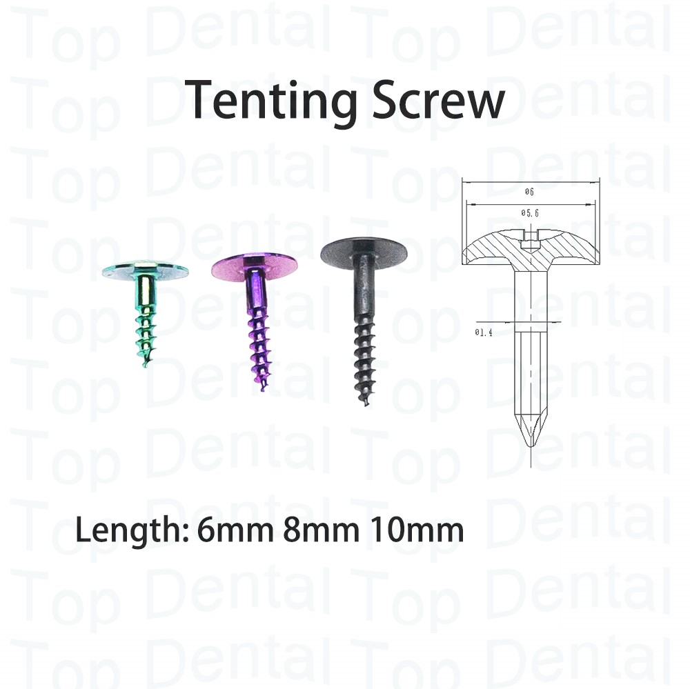 10pcs Dental GBR System Bone S - Stabilizer Screw In のレビューと価格