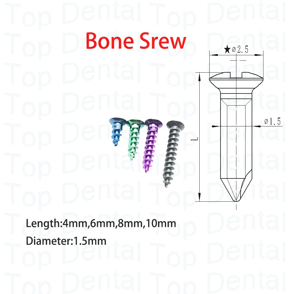 10pcs Dental GBR System Bone S - Stabilizer Screw In のレビューと価格